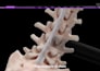 create 3d medical spine surgery animation surgical device 3d orthopaedic implant